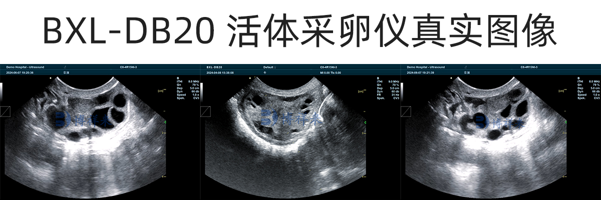 BXL-DB20 活体采卵超排.jpg
