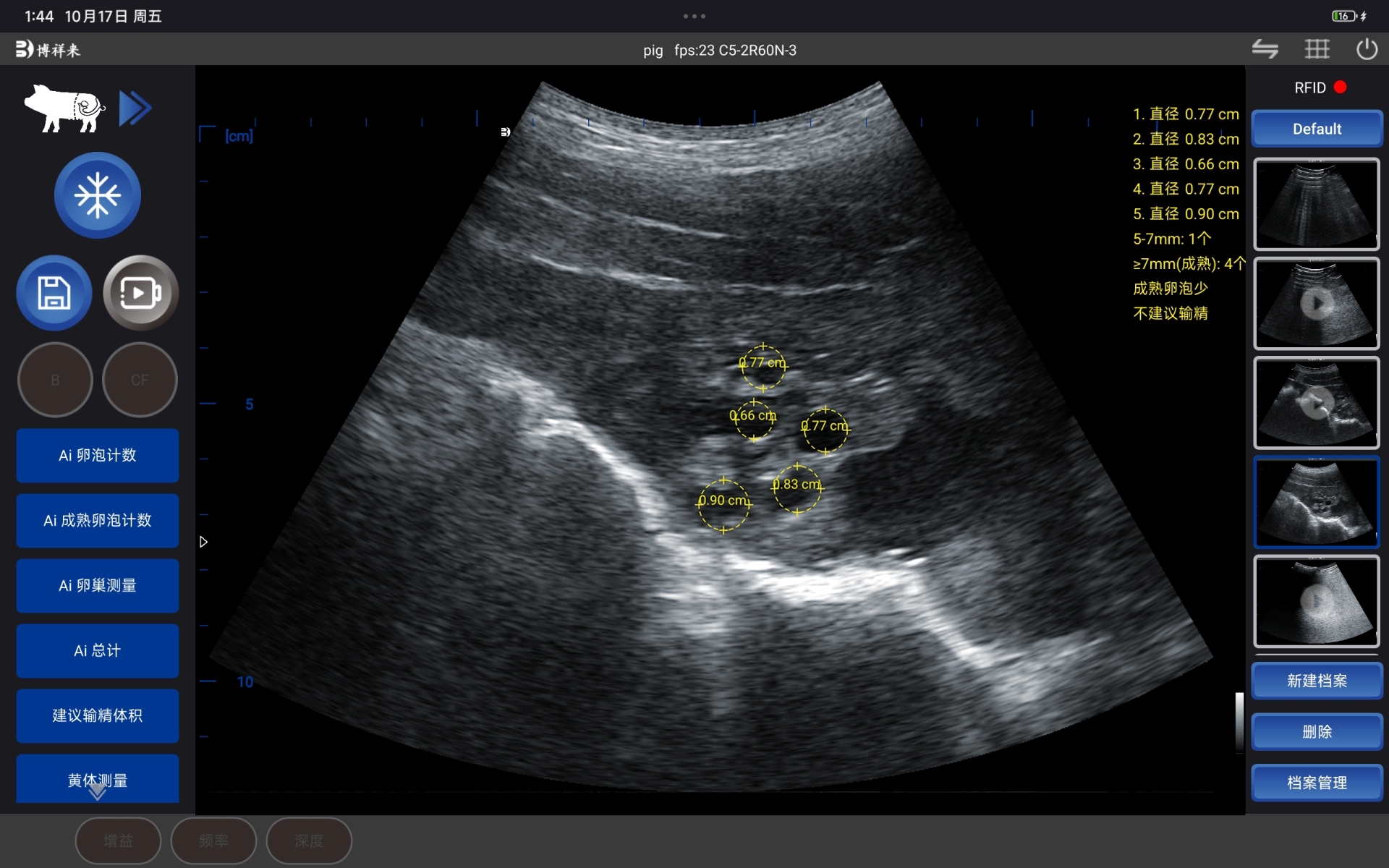 AI智能测猪卵泡界面 (4).jpg
