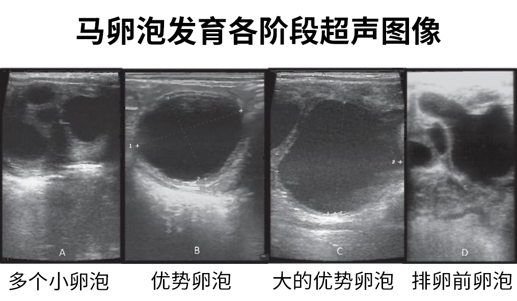 马各阶段卵泡超声.jpg