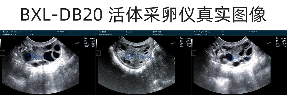 牛超排卵下的卵巢超声图像