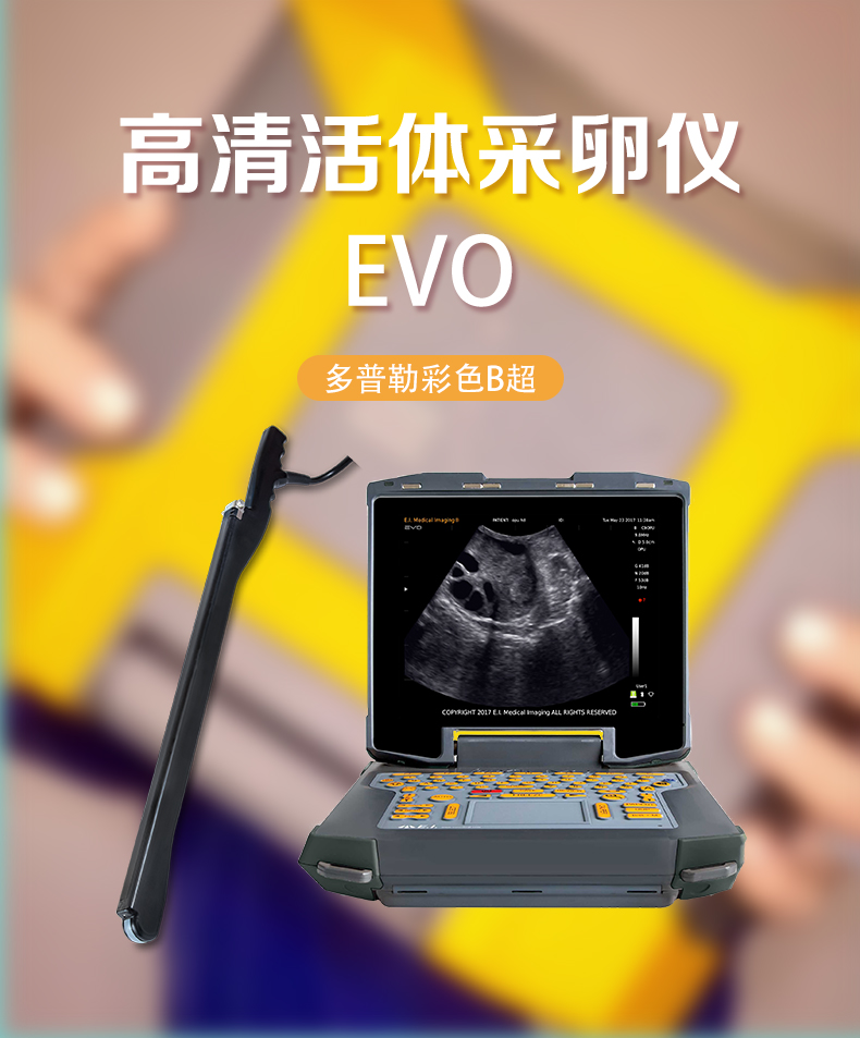 牛用活体采卵B超机EVO