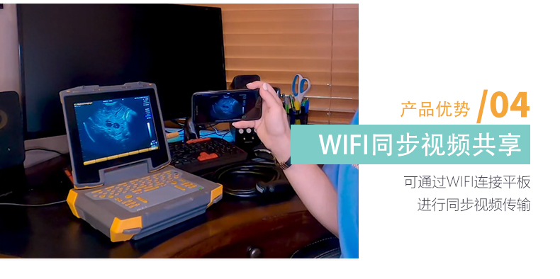 可通过wifi无线链接同步平板显示超声图像