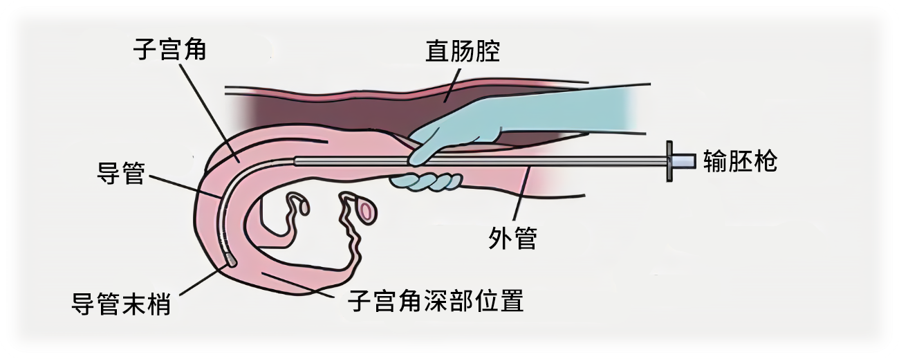 牛输胚过程